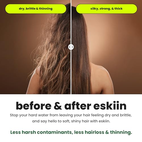 Eskiin Filtered Showerhead - Best Shower Head With Filters For Healthy Hair & Skin - High Pressure Water Softener For Hard Water - Reduce Dandruff, Protect Colored Hair, And Soothe Dry Skin (Chrome) - Image 4